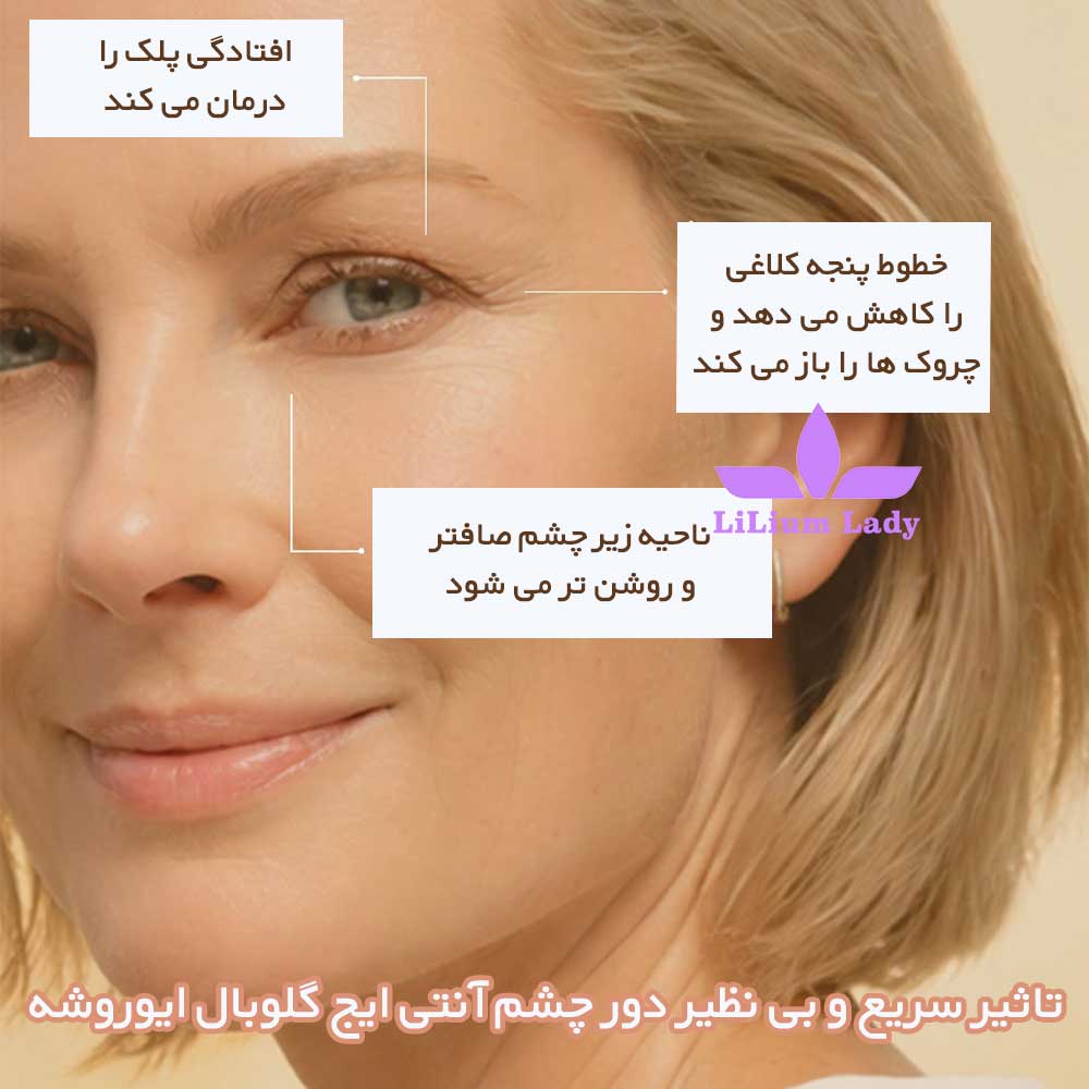 تاثیر-سریع-و-بی-نظیر-دور-چشم-آنتی-ایج-گلوبال-ایوروشه