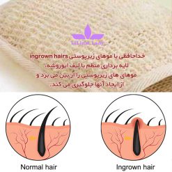 خداحافظی-با-موهای-زیرپوستی-ingrown-hairs