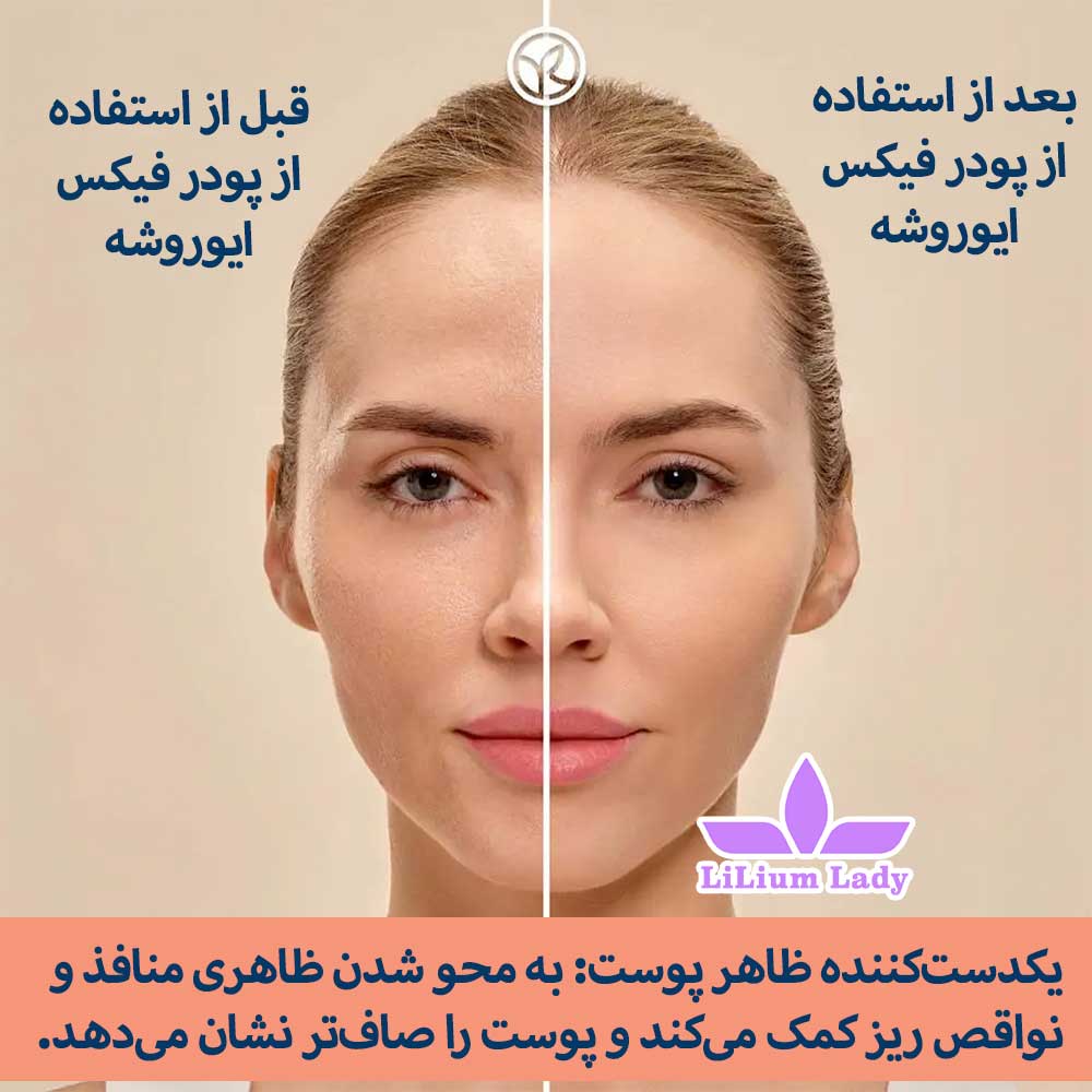 قبل-و-بعد-از-پودر-فیکس-ایوروشه